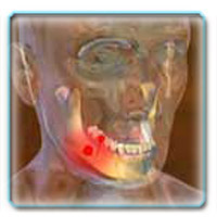 аллотрансплантация зубов