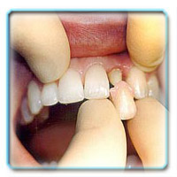 Коронковая часть зуба